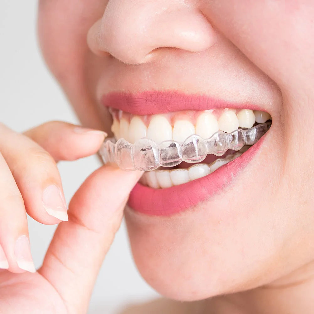 Anti Grinding Mouth Guard for Clenching Teeth at Night, Teeth Grinding Mouthguards for Sleeping, Mouth Guard for Grinding Teeth at Night, Night Guards for Teeth Grinding for Adults