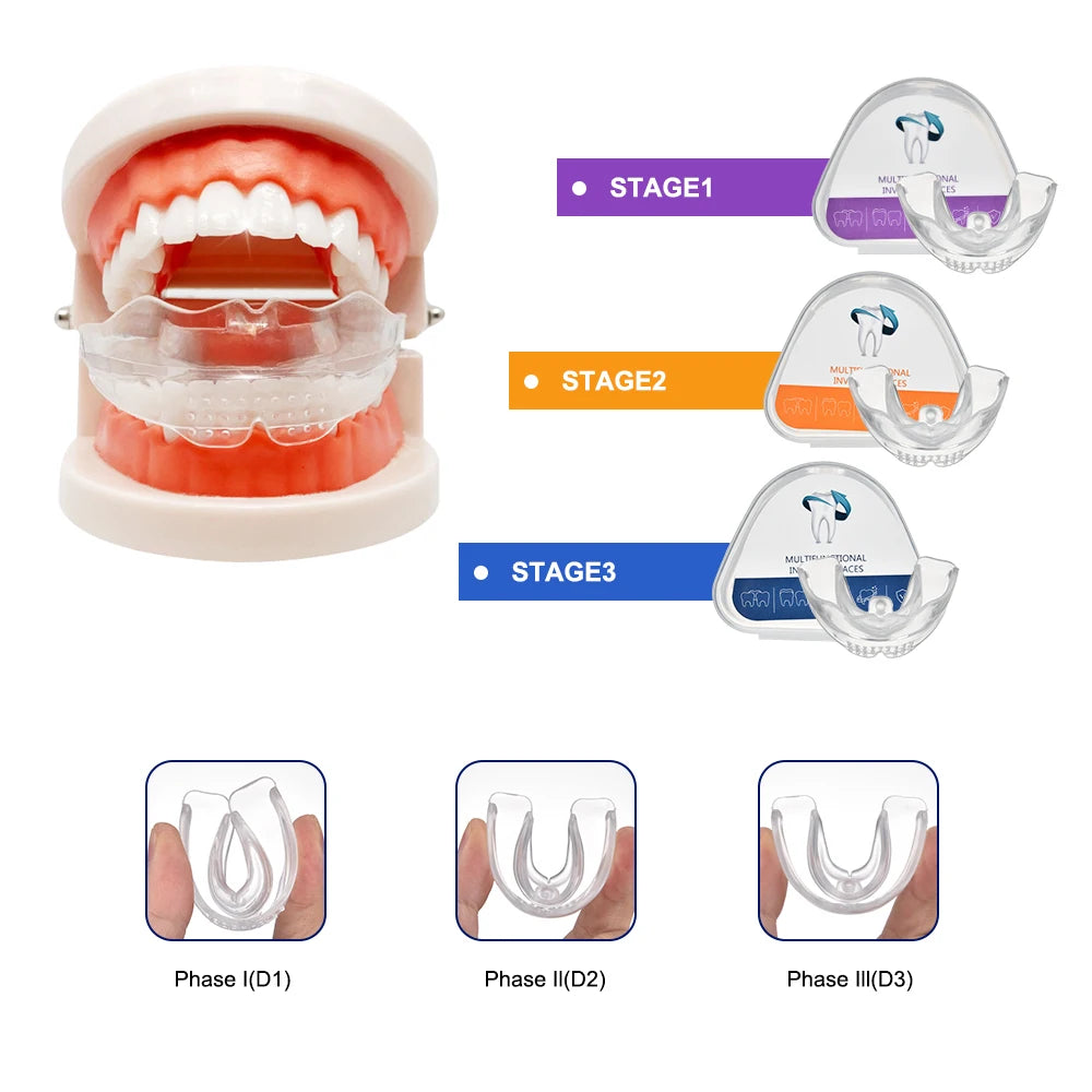 Custom Fit Hawley Retainer After Braces, Durable Dental Retainer, Upper & Lower Hawley Retainers for Teeth for Adults & Kids, 2 Pack