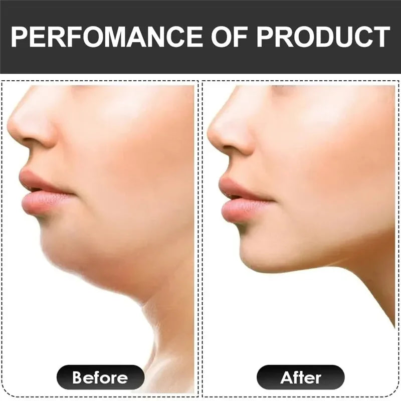 2pcs Achilles Fitness Double Chin Reducer Jaw Exerciser – Jawline Sculptor and Face Slimmer for Women and Men – Encourages Jaw Movement and Aids in Natural Jaw Function - Ideal for Mewing Practice
