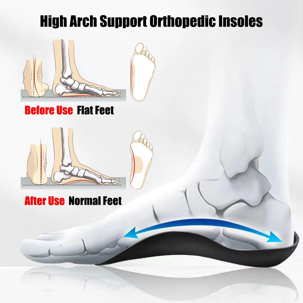 Plantar Fasciitis Insoles for Men Women - Orthotics Inserts, Shoe Insoles Arch Support Flat Feet Inserts Work Boot Insoles for Standing All Day