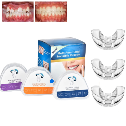 Custom Fit Hawley Retainer After Braces, Durable Dental Retainer, Upper & Lower Hawley Retainers for Teeth for Adults & Kids, 2 Pack